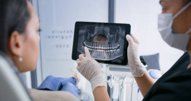 Licensed Teeth Whitening service in South Lancaster, MA - Smile Center Dentistry